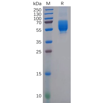 Human TGFBR1 Protein, hFc Tag