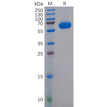 Human TFRC Protein, His Tag