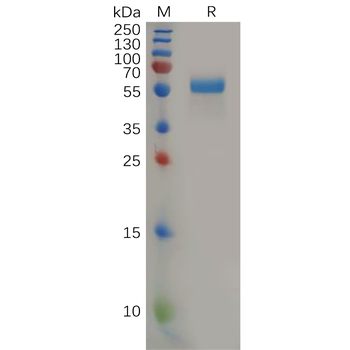 Human ADAMTS1 Protein, His Tag