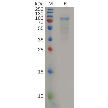 Human TPSAB1 Protein, His Tag
