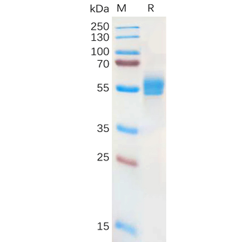 Human RNF43 Protein, hFc Tag