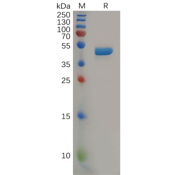 Human ADAM15 Protein, hFc Tag