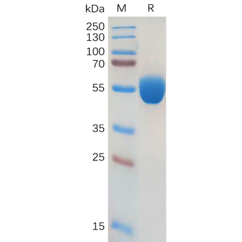 Human SPARC Protein, hFc Tag