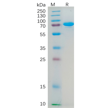 Human CLEC2D Protein, His Tag