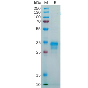 Human HSD17B10 Protein, S Tag
