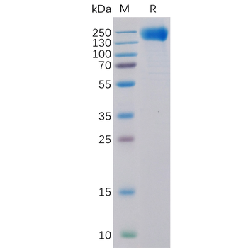 Human IL17RB Protein, His Tag