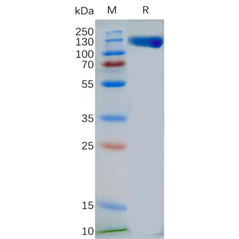 Human LILRB2 Protein, His Tag