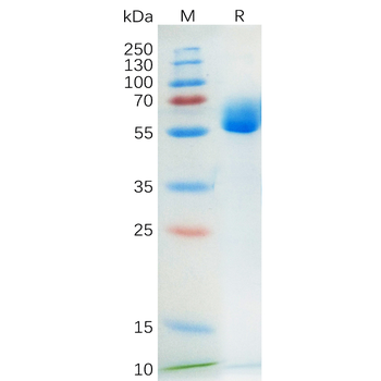 Human CD63 Protein, hFc Tag