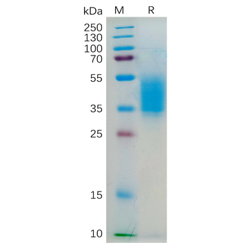 Human IL31 Protein, hFc Tag