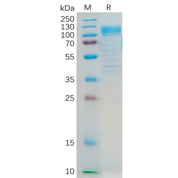 Human MUC18 Protein, His Tag