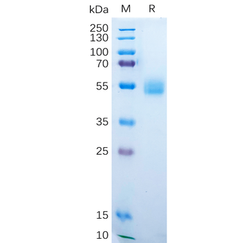 Human ZP3 Protein, His Tag