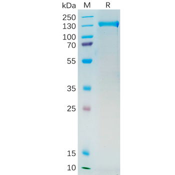 Human PRNP(90-230) Protein, hFc Tag