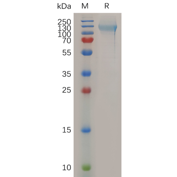 Human ADAM8 Protein, His Tag