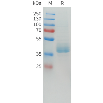 Mouse CD93 Protein, His Tag
