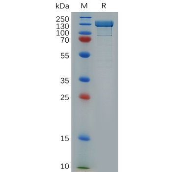 Human ADAM28 Protein, His Tag