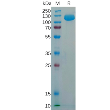 Human HPSE Protein, His Tag