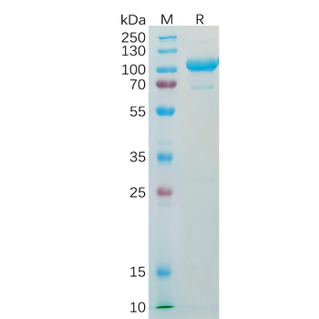 Human HSP90AA1 Protein, His Tag