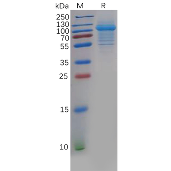 Human DAP10 Protein, hFc Tag