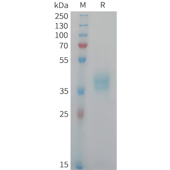 Cynomolgus CXCL4 Protein, hFc Tag