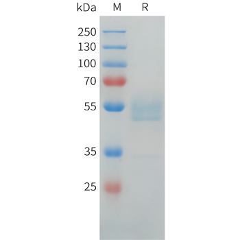Mouse NCL Protein, His Tag