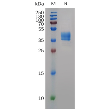 Human VEGFA Protein, hFc Tag
