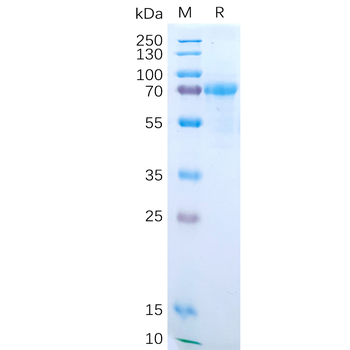 Human LIPG Protein, His Tag