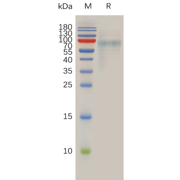 Human ADAM17(581-642) Protein, hFc Tag
