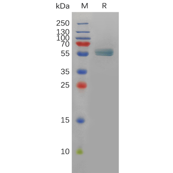 Human LALBA Protein, hFc Tag