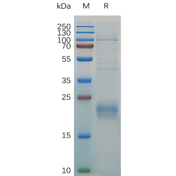 Human CXCL16 Protein, hFc Tag