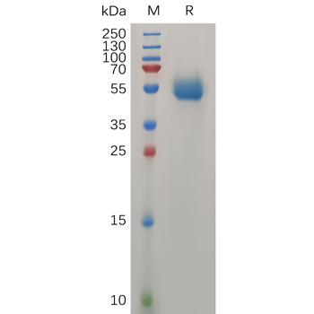 Human ULBP2 Protein, hFc Tag