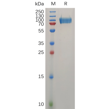 Human IFNGR1 Protein, hFc Tag