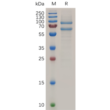Human RET Protein, hFc Tag