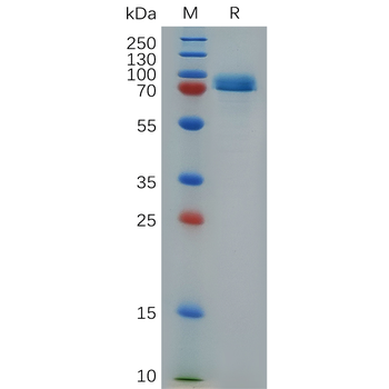 Human TGFB3 Protein, hFc Tag
