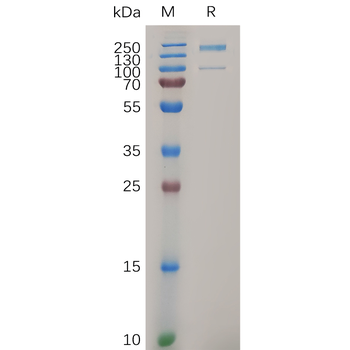 Human Myeloblastin Protein, hFc Tag