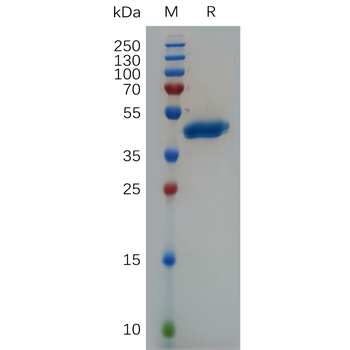 Human MRP1 Protein, hFc Tag