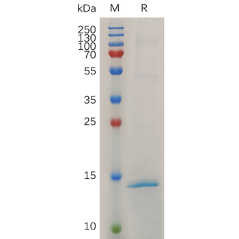 Human MMP2 Protein, His Tag