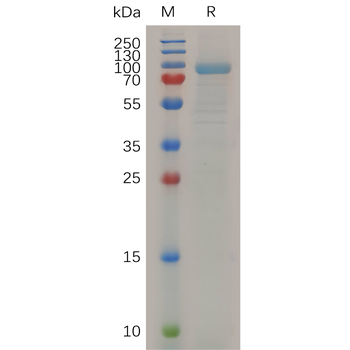 Human MERTK Protein, hFc Tag