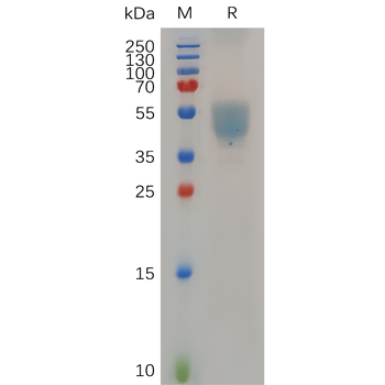 Human ITGB5 Protein, hFc Tag