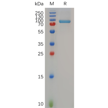Human IFNGR2 Protein, hFc Tag