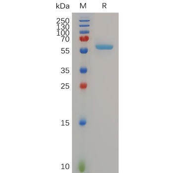 Human IFNB Protein, hFc Tag