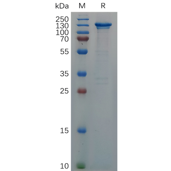 Human CXCL12 Protein, hFc Tag