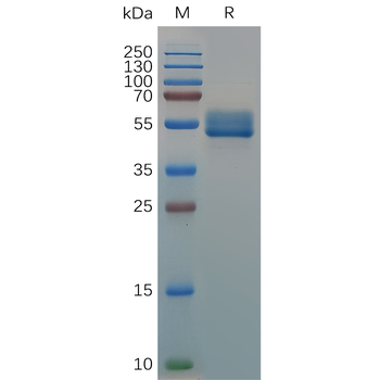 Human CX3CR1 Protein, hFc Tag