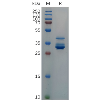 Human CSF Protein, hFc Tag