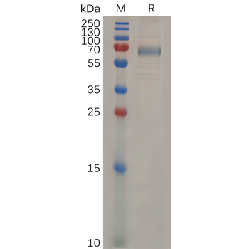 Human BAI1 Protein, hFc Tag