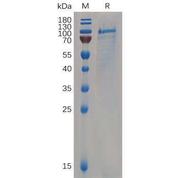 Human IL1R3 Protein, hFc Tag