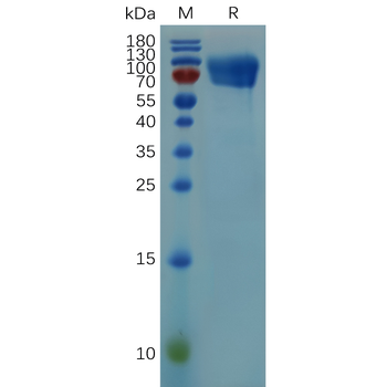 Human IL17A Protein, hFc Tag