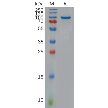 Human IL12RB1 Protein, His Tag