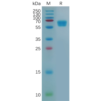 Human IL13 Protein, hFc Tag