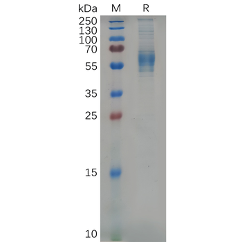 Human EMR1 Protein, hFc Tag