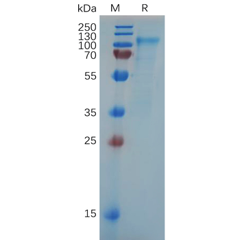 Human CLDN3 Protein, hFc Tag